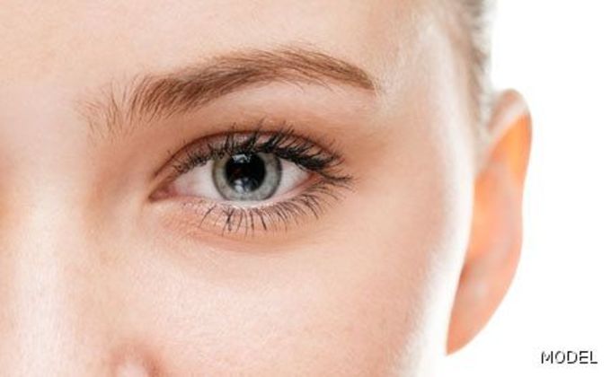 Eye Lift (Blepharoplasty) Cases