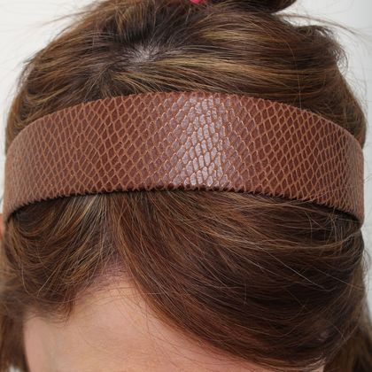 Hair Transplant - Female: Healing Series - Post-op 11 days after female hair transplant - Covered