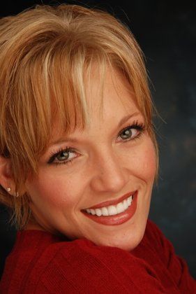 Veneers Case 1 - After