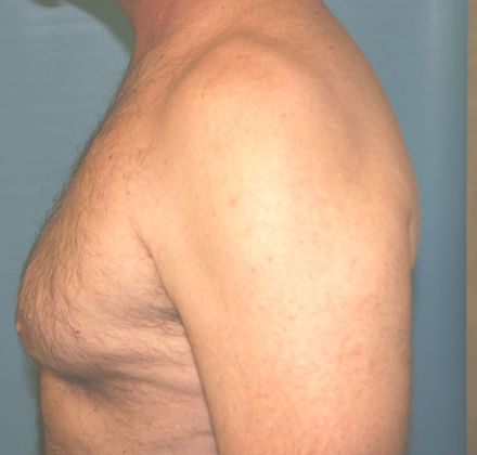 Large image
