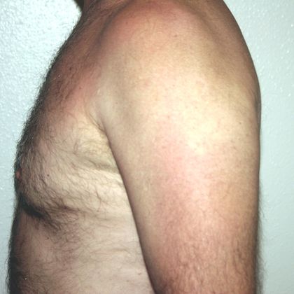 Large image