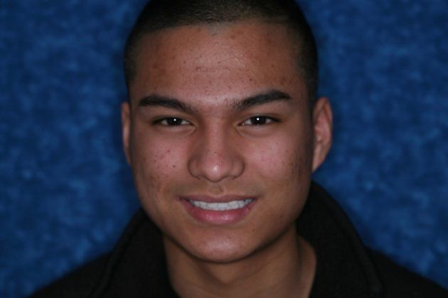 Bonded Maryland Bridge Cases