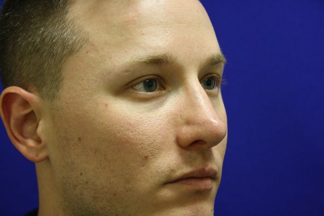 Rhinoplasty: Case 3 - After