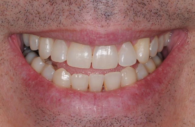 Orthodontics: Case 2 - After