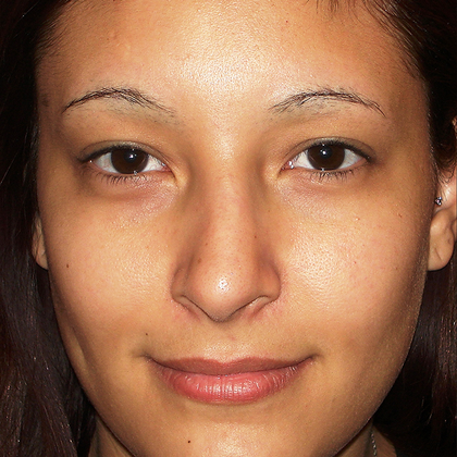 Permanent MakeUp Case 28 - Before
