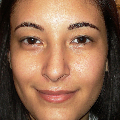Case 28 - Permanent MakeUp - Before and After Gallery