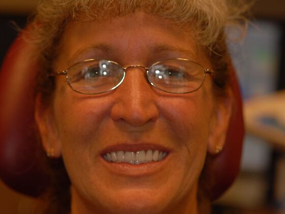 Dentures: Case 1 - After