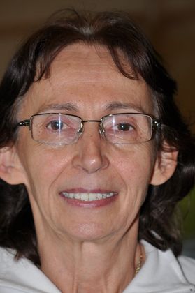 Full Mouth Restoration Full Mouth Restoration - After