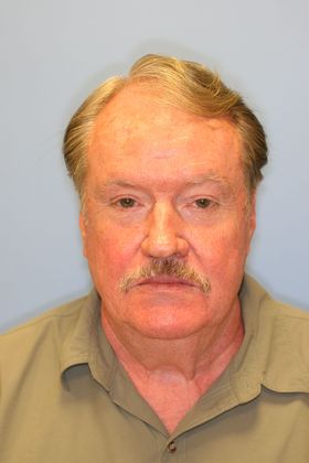 Facial Rejuvenation Case 5 - Before