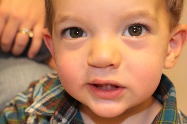 Cleft Lip and Palate Cases