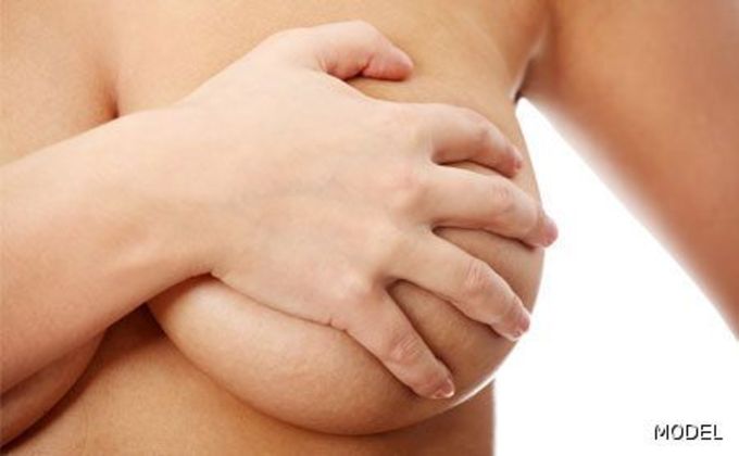 Breast Reduction/ Breast Lift Cases