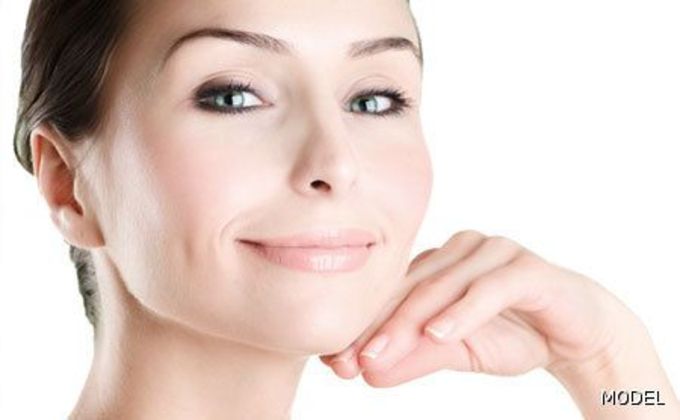 Chin Liposuction Cases