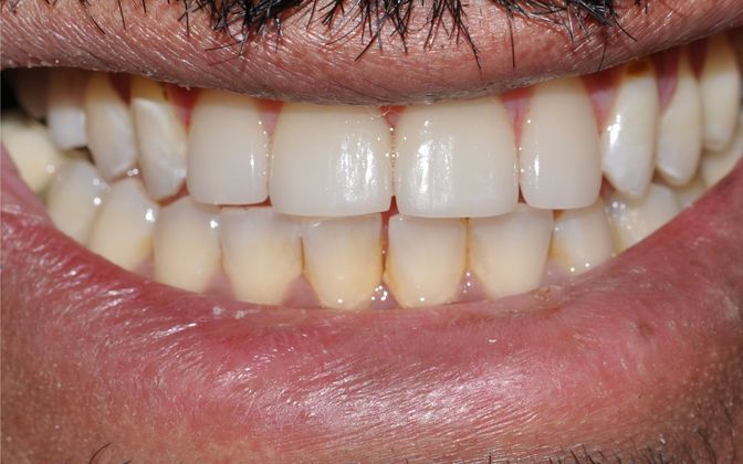 Crowns: Michael - After