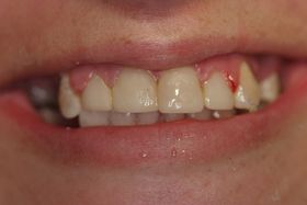 smile before a makeover