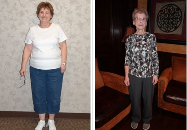 Laparoscopic Gastric Bypass Cases