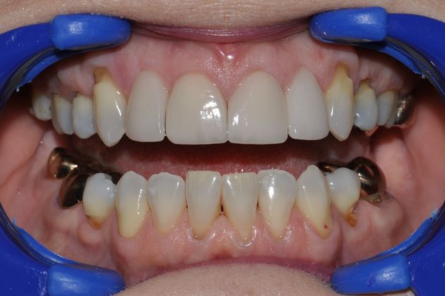 Crowns: Jessica - After