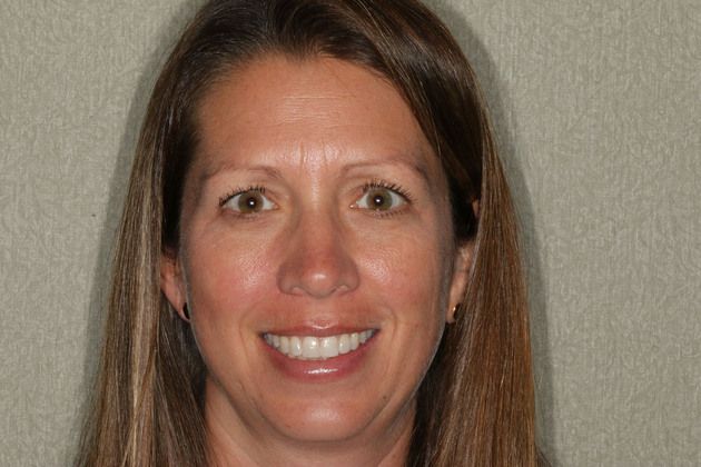 Cosmetic Dentistry Cases