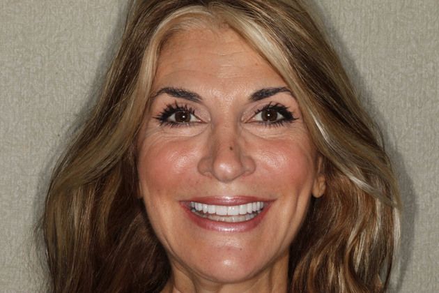 Smile Makeover Cases