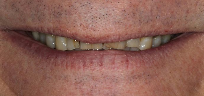 Cosmetic Dentistry Case 10 - Before