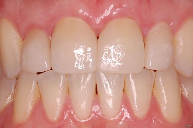 Cosmetic Dentistry Cases