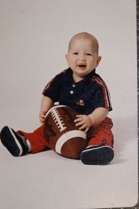 Cleft Lip*: Case 8 - After Cleft Lip Repair