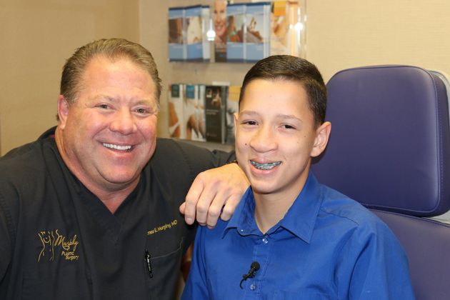 Cleft Lip*: Case 8 - With Dr. Murphy, After Nose Reconstruction.