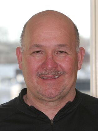 Full Mouth Reconstruction Case 3 - Before