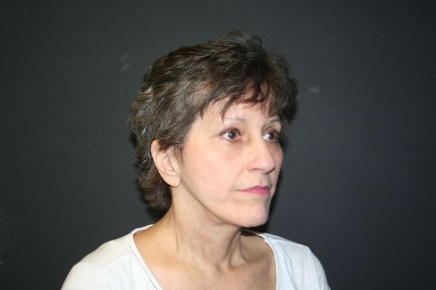 Facelift Case 7 - After