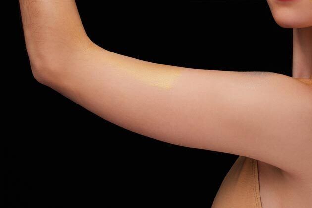 Arm Lift*/Arm Sculpting Cases