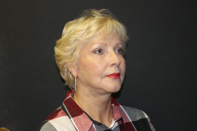 Facelift Case 13 - After