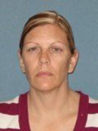 Obagi Blue Peel Case 7 - Before