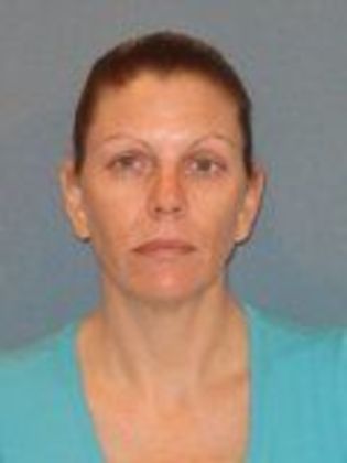 Obagi Blue Peel: Case 7 - After Blue Peel