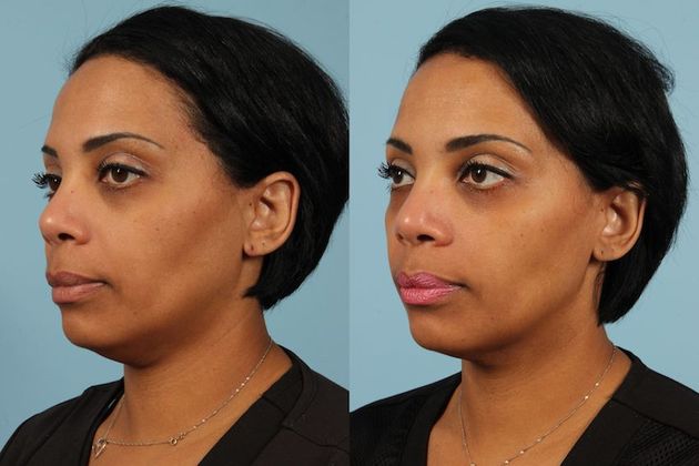 Seven before. Ffvii before crisis. Seven before. Rain at seven fine at eleven. Презентация weather английский.