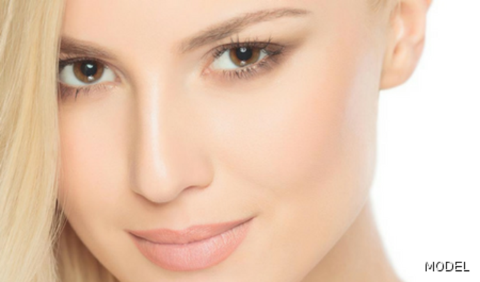 Bichatectomy (Cheek fat pad removal) Cases