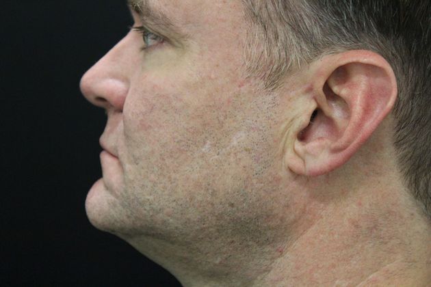 Skin Treatments: Case 1 - after