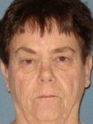 Ptosis Repair: Case 5 - Before Surgery