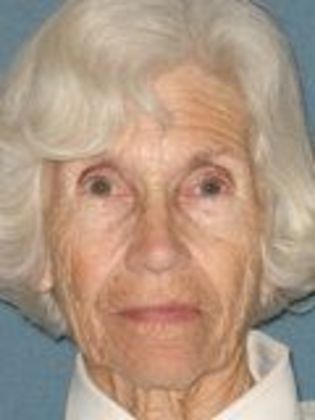 Ptosis Repair: Case 7 - After Surgery