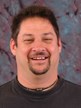 Full Mouth Reconstruction Case 7 - Midland Park - Before