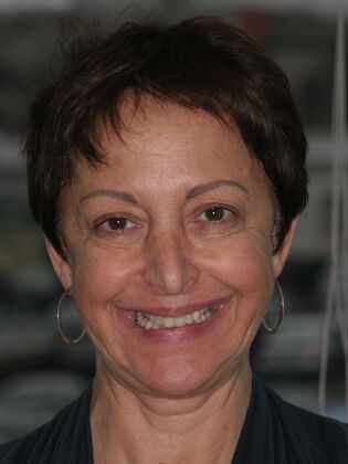 Full Mouth Reconstruction Case 10 - Bergen County - Before