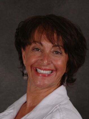 Full Mouth Reconstruction Case 10 - Bergen County - After