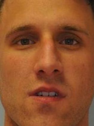 Rhinoplasty: Case 9 - Rhinoplasty, Norwalk - Before