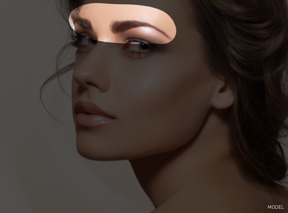 Browlift/Forehead Lift Cases