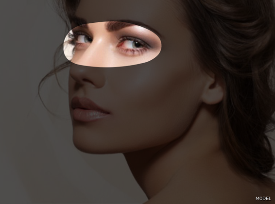 Eyelids (Blepharoplasty) Cases