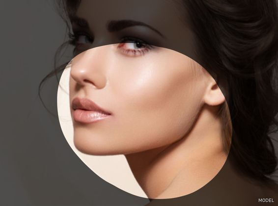 Facelift (Rhytidectomy) Cases