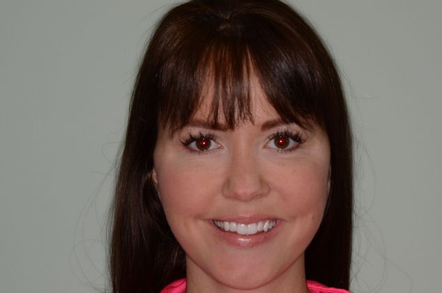 Porcelain Veneers: Case 10 - Before smile