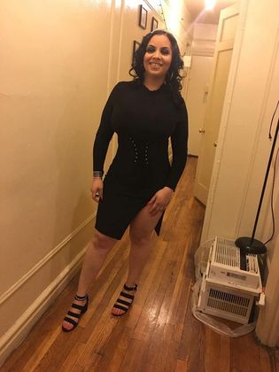 Gastric Sleeve Case 1 - After