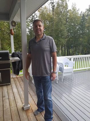 Gastric Sleeve Case 3 - After