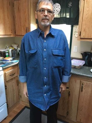 Gastric Sleeve Case 6 - After