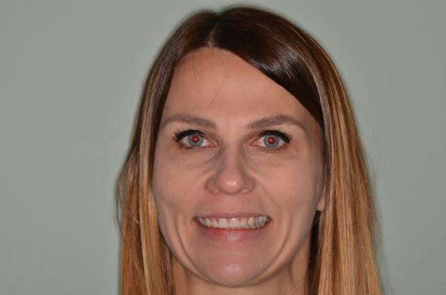 Porcelain Veneers: Case 2 - Before