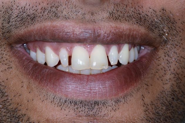 Cosmetic Dentistry Case 1 - Before